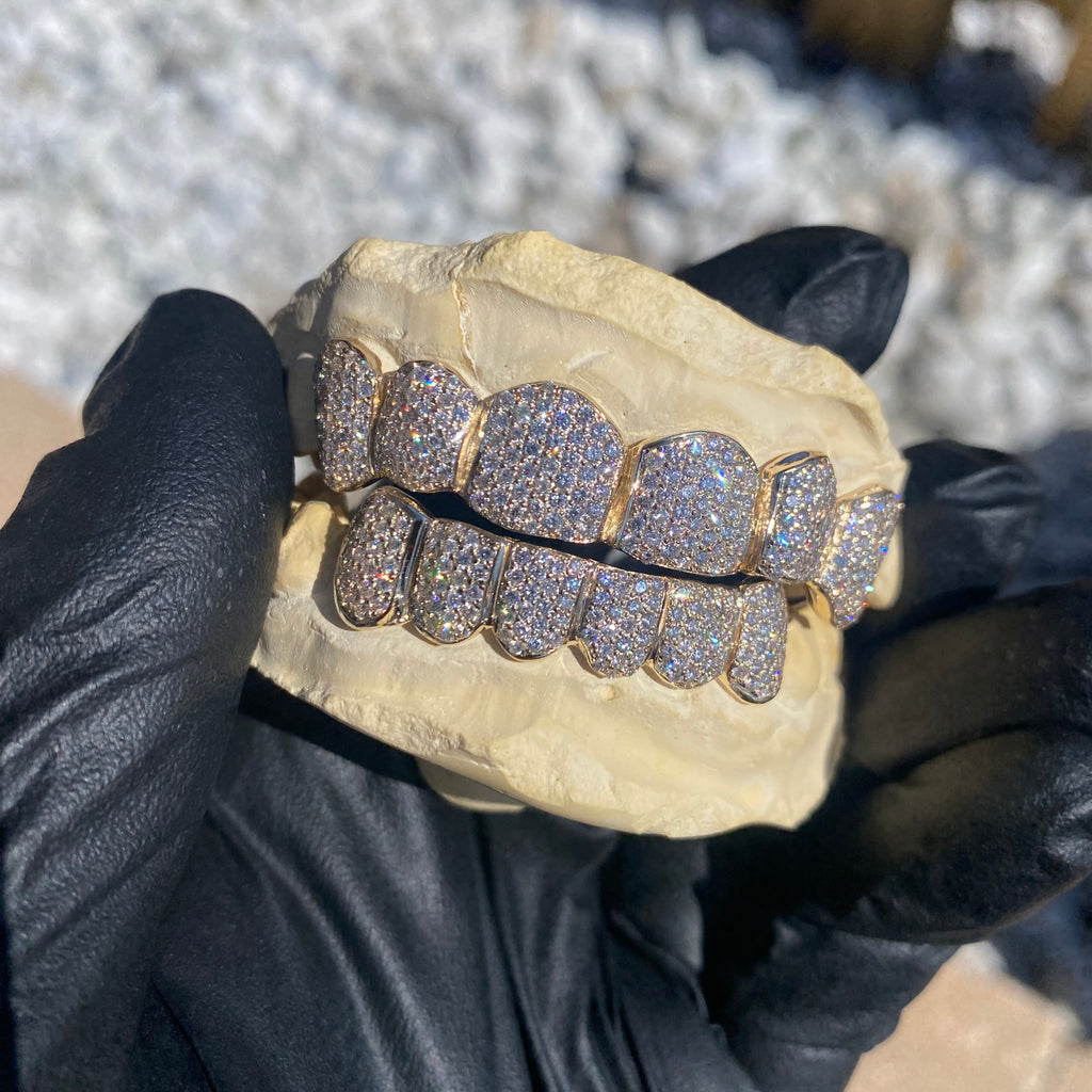 Custom Diamond Grillz by Sev7n 6x6 "Bussdown"